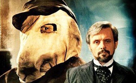 Joseph Merrick (1862-1890)